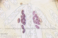 Ascobolus stercorarius