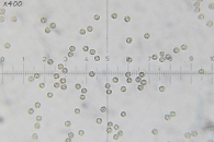 Lycogala epidendrum (J.C. Buxb. ex L.) Fr.