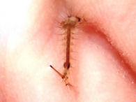Culicidae -larva-