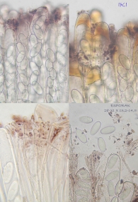 Pseudombrophila hepatica (Batsch) Brumm. 1995