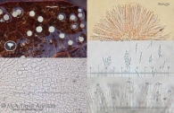 Incrucipulum ciliare (Schrad.) Baral 1985