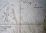 Peziza micropus Pers. (1800), [RSD]; Pezizaceae 5