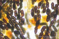 Eutryblidiella hysterina (Dufour) Petr. 1959